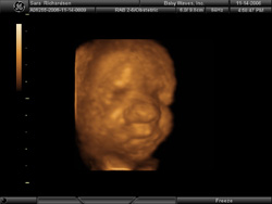 My Face - BabyWaves 3D